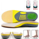 Orthopedic Insoles Man Woman Arch Support Flat Foot Correction Sports Camping Massage Breathable Sweat-absorbing Cushion Pad